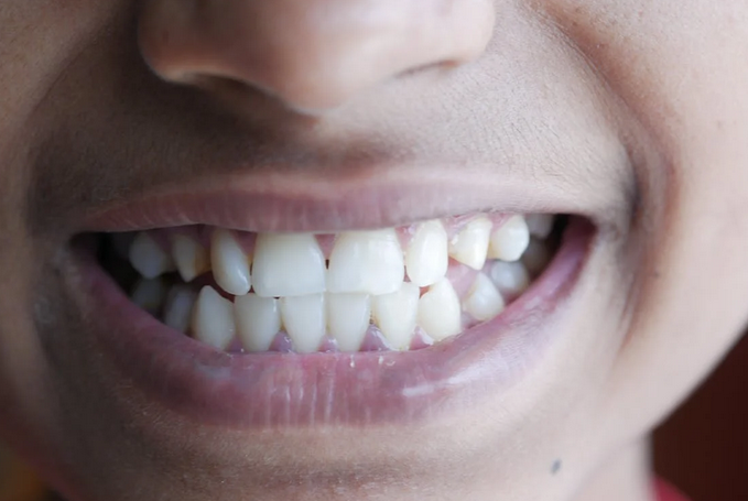 teeth